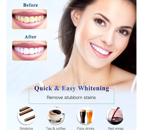 V Kit De Luz En Gel Blanqueador De Dientes Whitenes