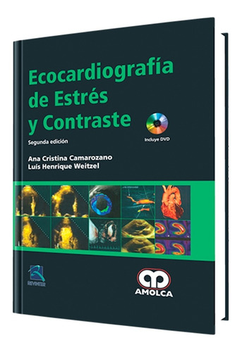 Ecocardiografía De Estrés Y Contraste. 2 Edición.