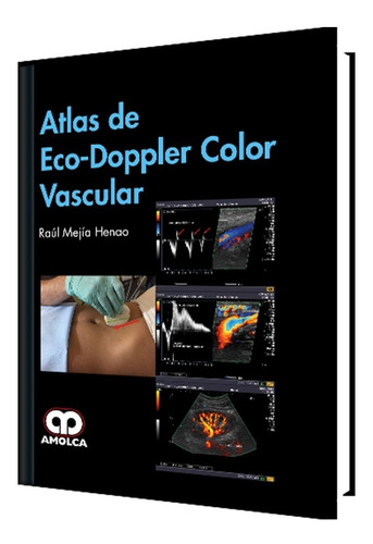 Atlas De Eco Doppler Color Vascular.