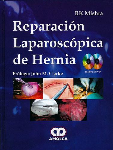 Reparacion Laparoscopica D Hernia  2 Dvd