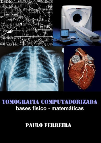 Tomografia Computadorizada: Bases Físico - Matemáticas, De Paulo Ferreira. Série Não Aplicável, Vol. 1. Editora Clube De Autores, Capa Mole, Edição 1 Em Português, 2018