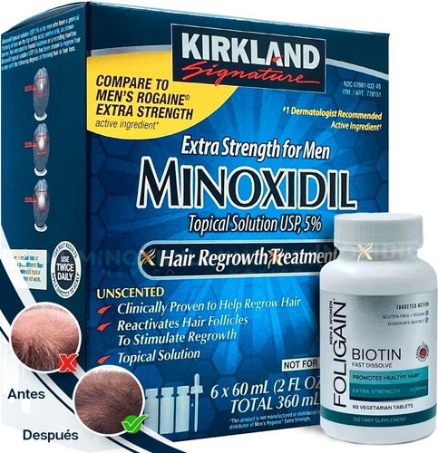 Imagen 1 de 5 de Minoxidil 5% + Biotina 10,000 Ultima Generación 60 Tabletas
