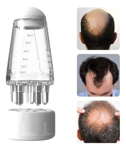 Bola De Aceite Esencial Para Cabeza V Minoxidil Administrati