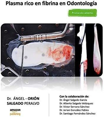 Libro: Plasma Rico En Fibrina En Odontología: Protocolo