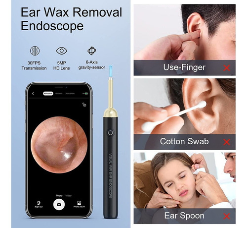 Wi-fi Visual Earpick - Kit De Herramientas De Eliminación De