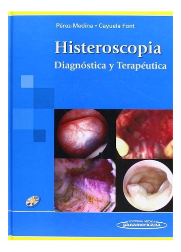 Histeroscopía. Diagnóstica Y Terapéutica. Incluye Dvd