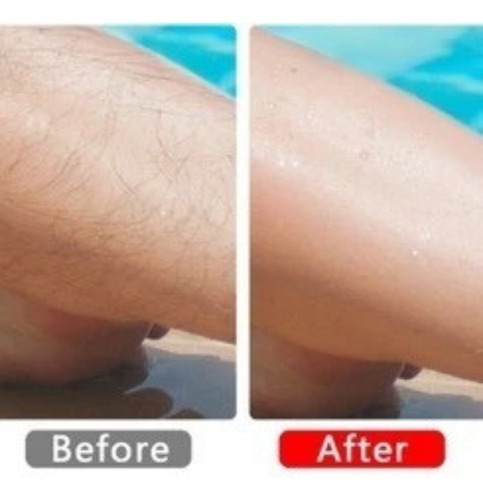 Depilador Removedor De Pelos Mágico E Indolor Esfoliante Multicolor