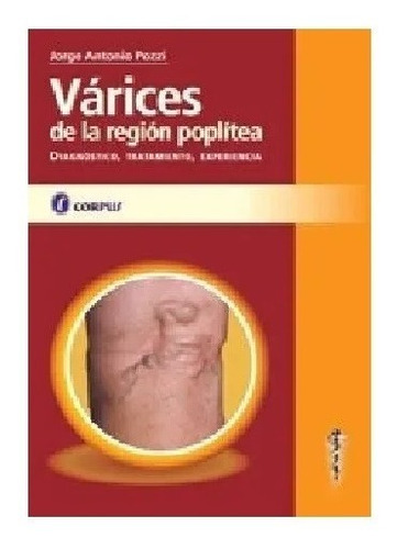 Varices De La Región Poplítea