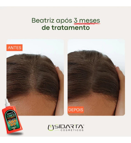 Kit Das Famosas: Tônico Sidarta, Shampoo E Condicionador