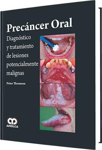 Precáncer Oral. Diagnóstico Y Tratamiento De Lesiones Potencialmente Malignas, De Peter Thomson. Editorial Amolca, Tapa Dura En Español, 2015