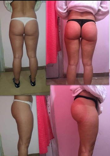 Imagen 4 de 5 de Adelgaza, Modela, Tonifica, Reduce. Todo El Cuerpo!