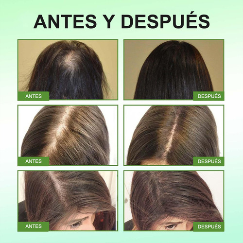 5 Pcs Aceite De Argán Morocco Argan Oil 59 Ml Tratamiento
