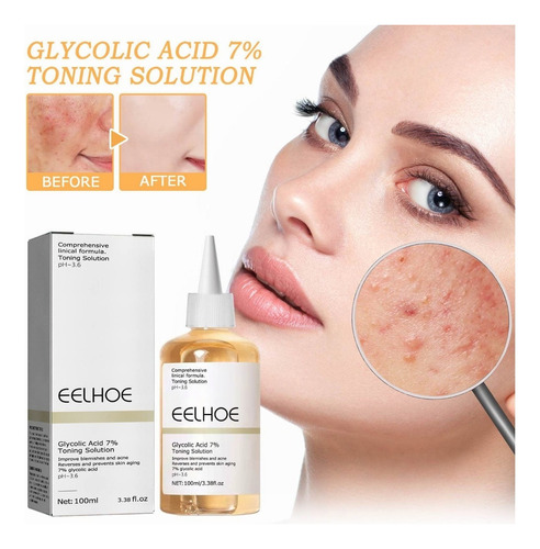 Exfoliante Facial Con Ácido Glicólico Al 7%, Astringe Los Po