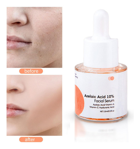 Ácido Azelaico 10% Soro Facial Vitamina C Melhora A