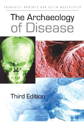 Libro The Archaeology Of Disease - Charlotte Roberts