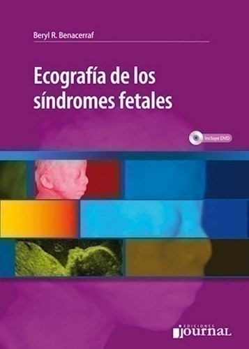 Ecografía De Los Síndromes Fetales - Benacerraf, Beryl R. (