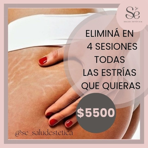 Imagen 1 de 1 de Tratamientos Corporales