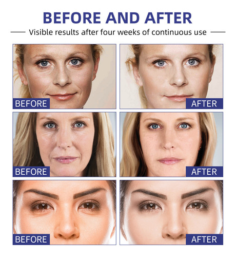 Melhorando A Firmeza Da Pele 40g De Creme Facial Hidratante