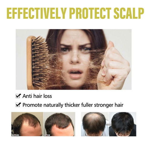 Shampoo Para Cabelo Com Extrato Vegetal H Ganoderma Nigrum G