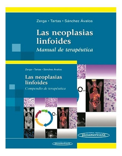 Las Neoplasias Linfoides 