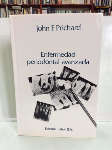 Enfermedad Periodontal Avanzada - Odontología - Prichard