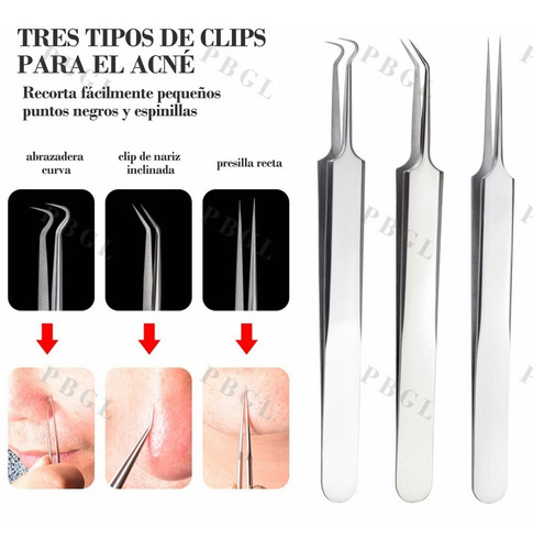 Set Herramientas Acné. Extractor De Espinilla Puntos Negros