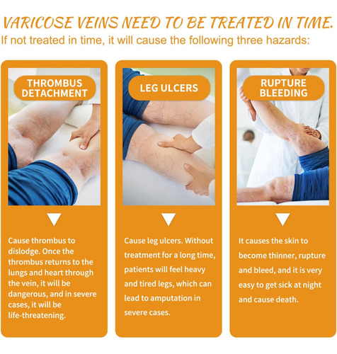 2pcs Venas Varicosas Crema Milagrosa Con Vitamina K Adecuado
