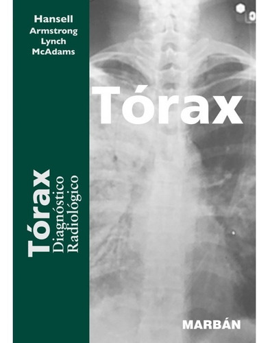 Torax Diagnostico Radiologico    