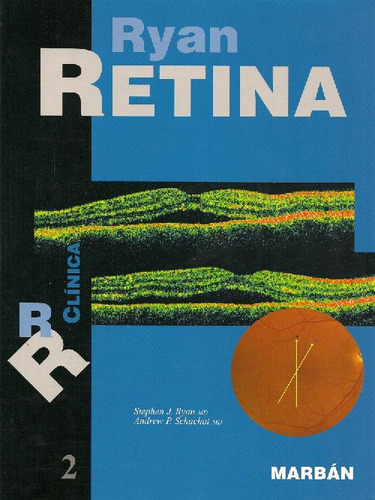 Libro Retina - Volumen 2 De Andrew P Schachat Stephen J Ryan