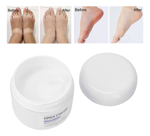 Crema De Urea Resequedad Extrema Codos Talones Pies