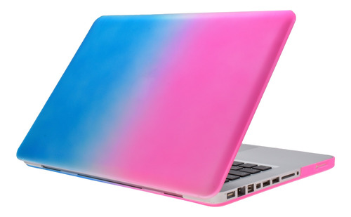 Carcasa Case Protector Para Macbook Pro 15 Model A1286