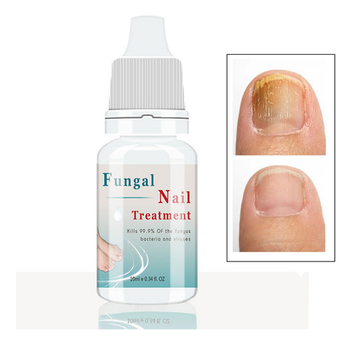 Suero Natural Para Hongos En Uñas - Pies Y Manos Eficaz