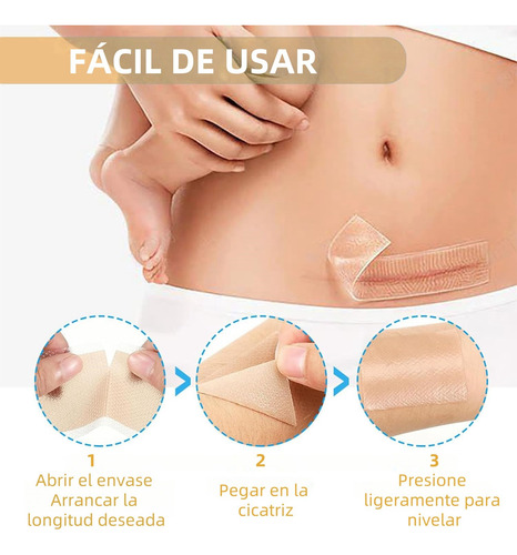 4cm*1.5 Metros Parche Silicón Reutilizable Cicatrices Rollo