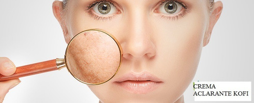 Imagen 2 de 2 de Crema Aclarante Kofi Para Manchas