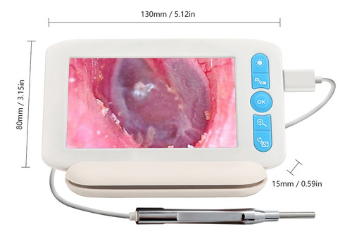 Imagen 9 de 9 de Otoscopio Digital Con 6 Luces Led 32g Tfcard 3.9mmm 1080p