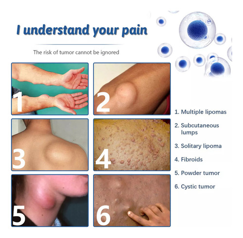 Productos Para El Cuidado De La Piel Lipoma Fatty Knot En Ae
