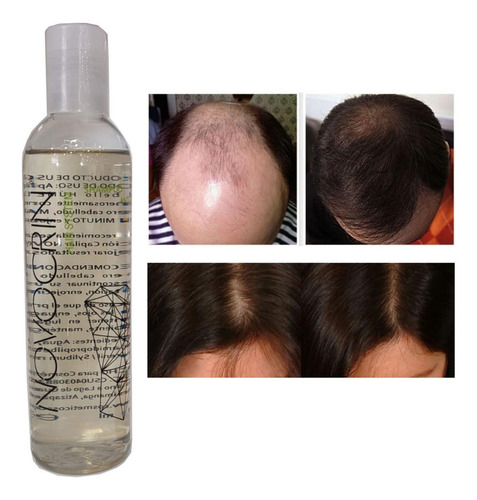 Cabello Mas Fuerte Y Mas Abundante, Mxshw-004, 5 Pza, 250ml