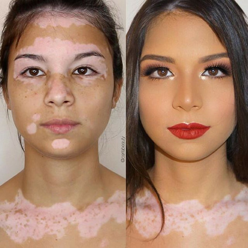Primer Facial + Base Que Cobre Melasma Queimaduras Manchas