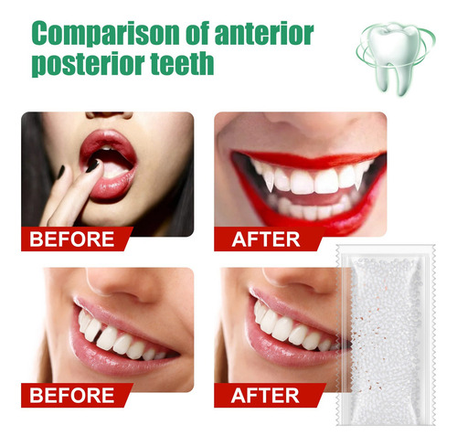Cosmético Dientes Dent,1 Par Temporal Sonrisa Confort Ajuste