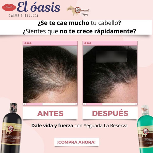 Shampoo Rojo Yeguada La Reserva 100% Original 1 Litro