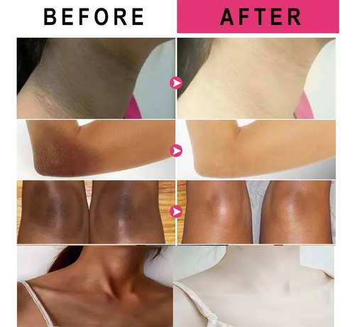 Crema Blanqueadora Oscura, Piel De Entrepierna, Cuerpo Y Axi
