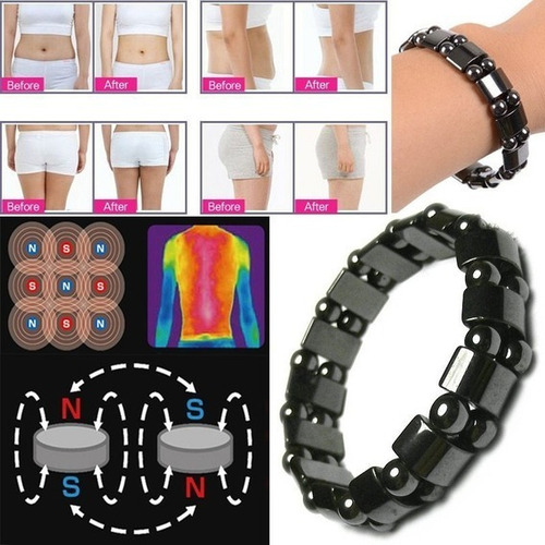 Pulsera Magnética De Hematites Elasticada Para Hombre/mujer