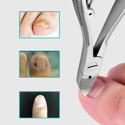 Cortauñas Crystally-2x Professional Para Pies Y Pies, Corte