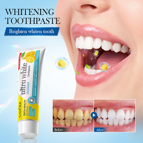 Pasta De Dientes Blanqueadora Y Quitamanchas I Lemon Oral Wh
