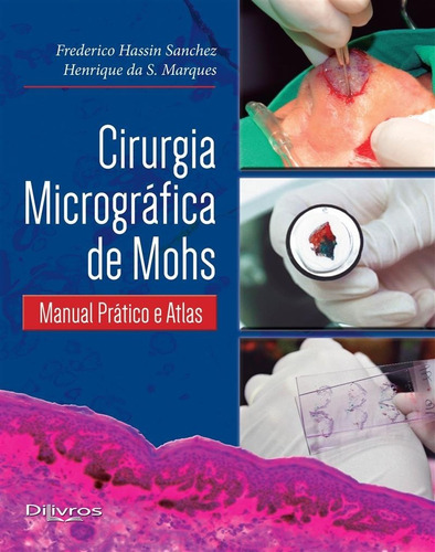 Livro: Cirurgia Micrografica De Mohs
