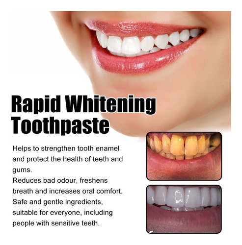 & Pasta De Dientes C Blanqueadora Bucal Plaster Sp Y6 Pasta