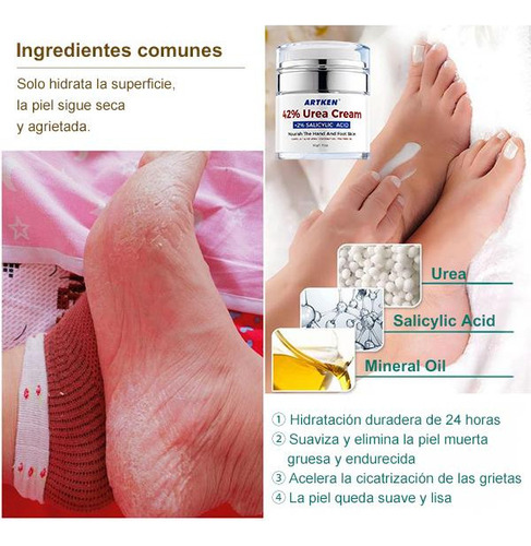 // Artken Reparación Para Pies Agrietados Y Resecos - Crema