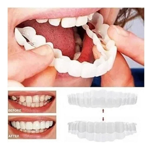 Mox Silicona Superior/inferior Sorriso Dentes Falsos