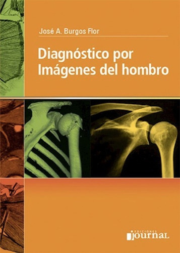 Diagnóstico Por Imágenes Del Hombro - Burgos Flor