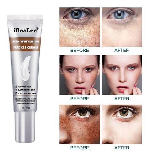 Creme Facial Clareador Hidratante, Clareador E Clareador Fac